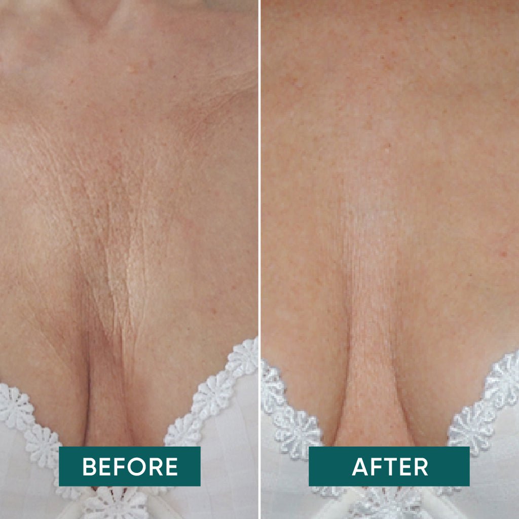 Décolleté pad herbruikbaar siliconen met ectoin