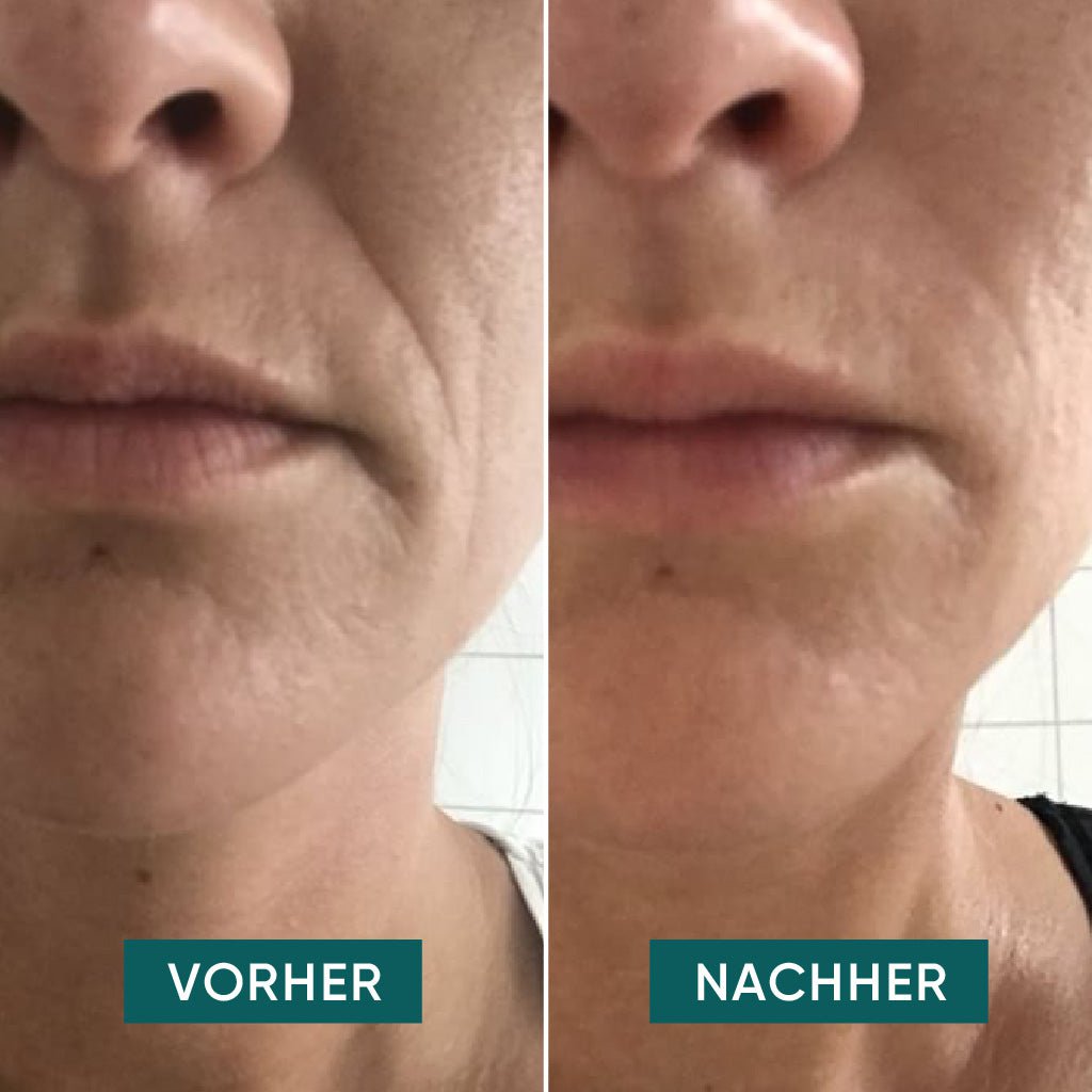 Apricot mond pads met hyaluron